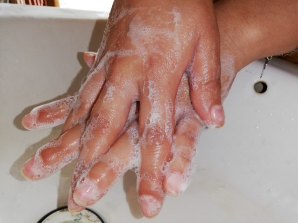 extremando las precauciones en niños menores de 5 años de edad y adultos mayores.