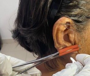 Sin casos nuevos de lepra en Oaxaca